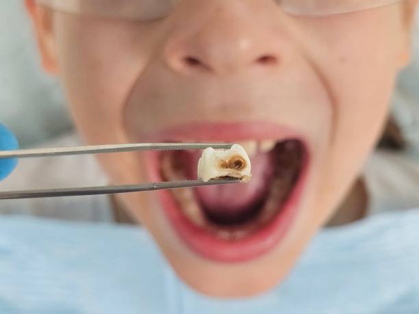Best Urgent Dental Care for Toothache in Clio, AL